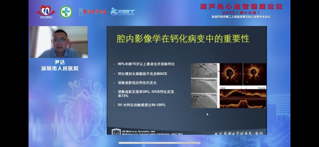 葫蘆島心血管健康論壇?2022｜創(chuàng)新驅(qū)動發(fā)展，不斷提升心血管疾病救治能力(圖11)